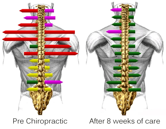 MyoVision Digital Chiropractic Scan